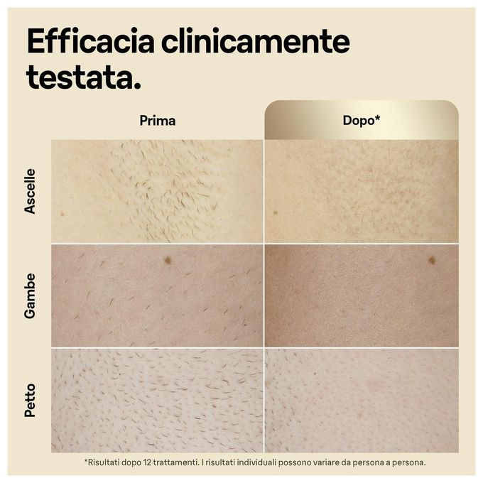Braun PL5356 Silk-expert Pro 5 Epilatore Luce Pulsata IPL 10 intensita' 125 impulsi-min con Custodia e Rasoio Venus colore Oro Bianco